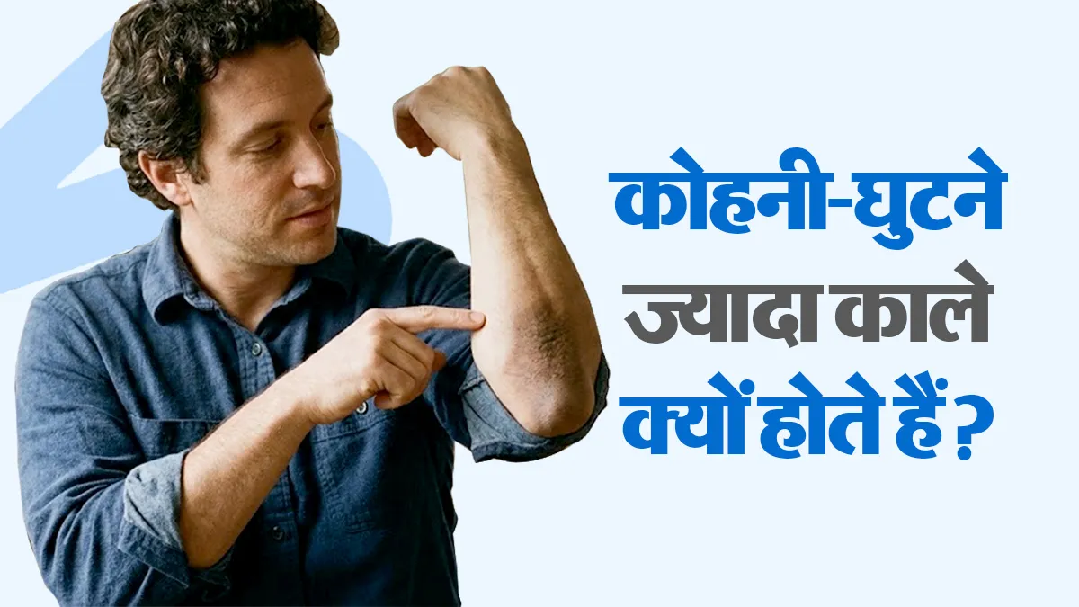कोहनी और घुटने बाकी शरीर से ज्यादा काले क्यों हो जाते हैं? डर्मेटोलॉजिस्ट से जानें