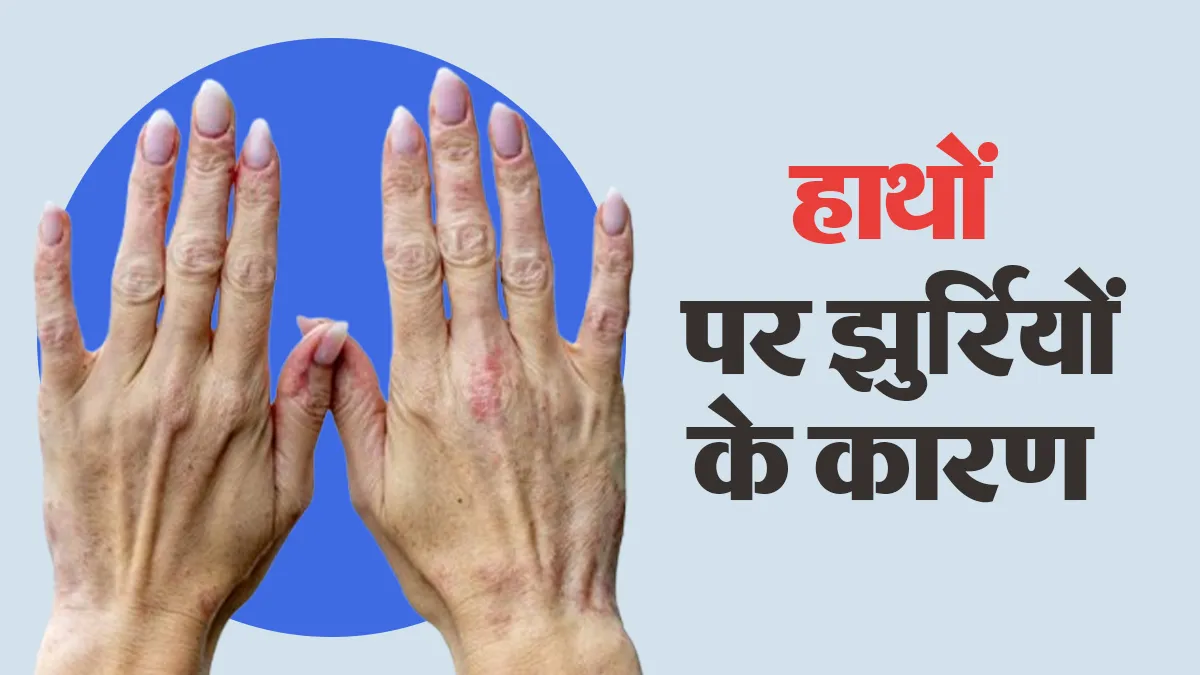 हाथों पर अचानक महीन झुर्रियां क्यों दिखने लगती हैं? स्किन में बदलाव की ये 5 वजहें जानें