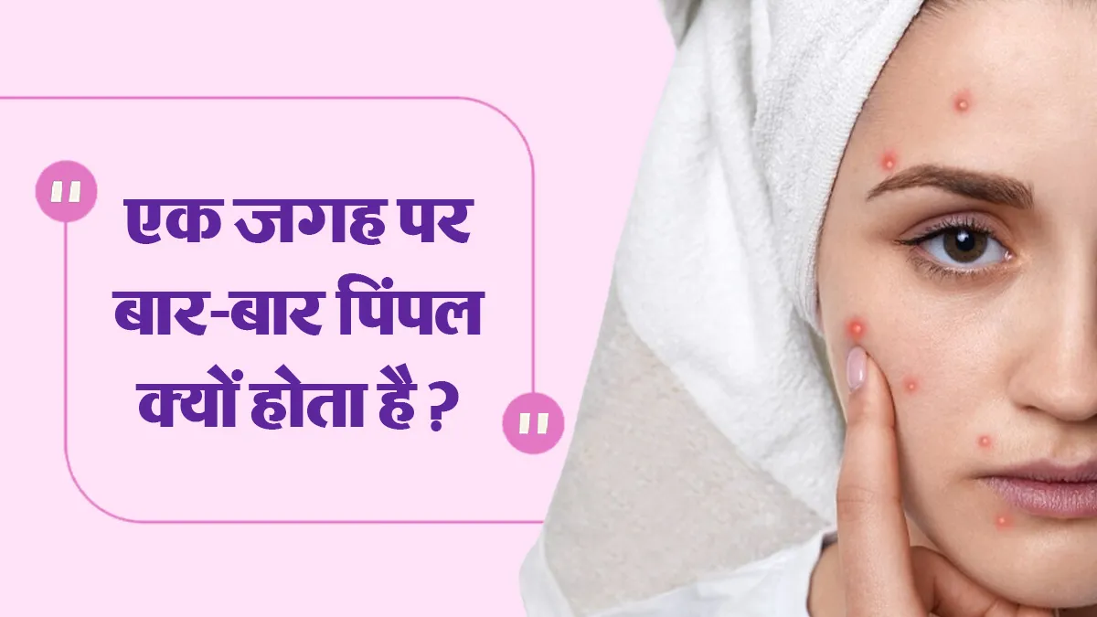 एक ही जगह पर बार-बार पिंपल क्यों निकलता है? डॉक्टर से जानें