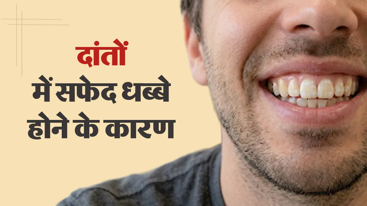 दांतों में सफेद धब्बे होने के क्या कारण हैं? डेंटिस्ट से जानें