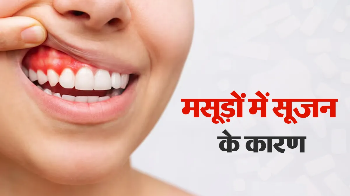 मसूड़ों में अचानक सूजन आने का क्या कारण है? डेंटिस्ट से जानें