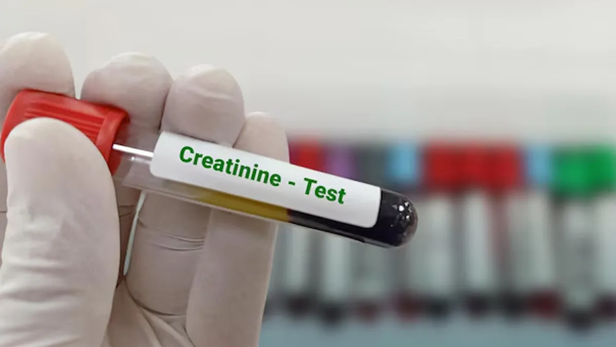 high creatinine symptoms