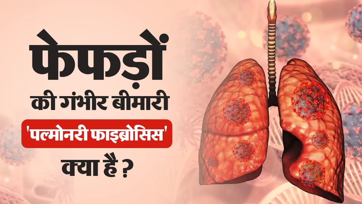 फेफड़ों की गंभीर बीमारी 'पल्मोनरी फाइब्रोसिस' क्या है? डॉक्टर से जानें लक्षण, कारण और इलाज