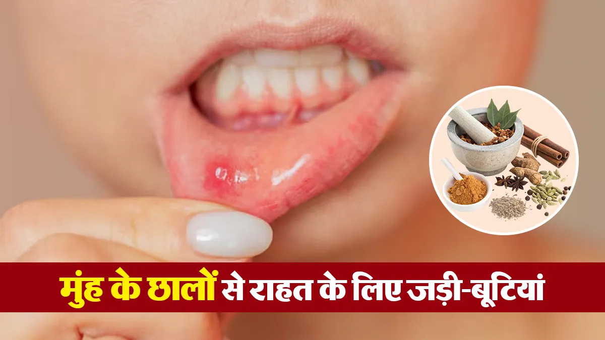 मुंह के छालों से हो गए हैं परेशान? इन 6 आयुर्वेदिक जड़ी-बूटियों से मिलेगा आराम
