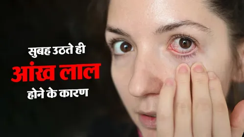 सुबह उठते ही लाल हो जाती हैं आंखें? डॉक्टर श्रेया गुप्ता से जानें इसके पीछे की खतरनाक वजहें और बचाव के उपाय