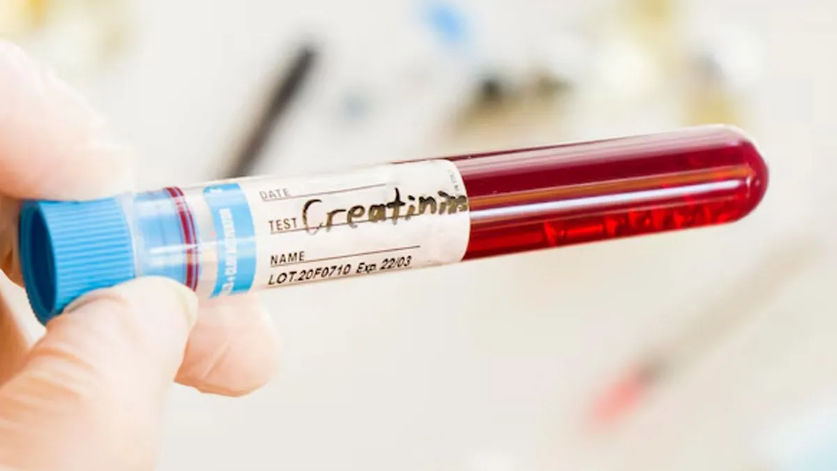 test-for-heart-health
