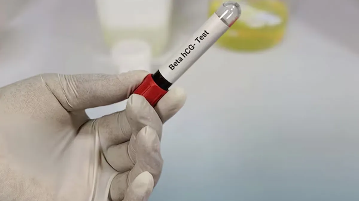 what is a good hcg level
