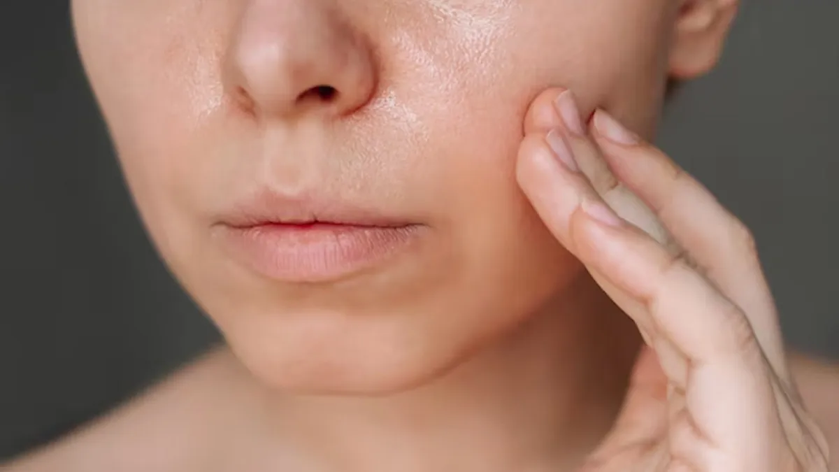 Oily-Skin-Care-Tips