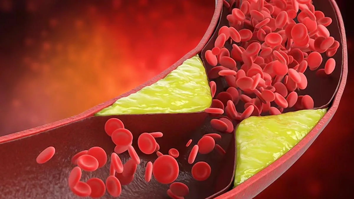 should you eat eggs if your cholesterol is high know from doctor how to include them in your diet  1
