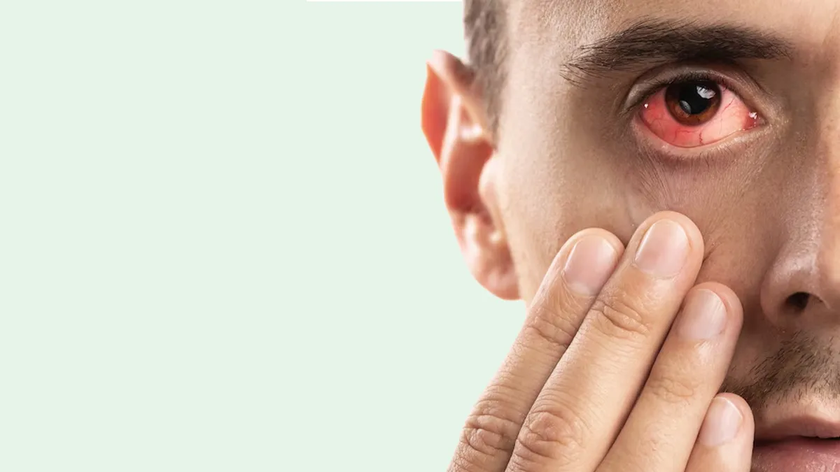 Causes Of Heavy And Burning Eyes In The Morning