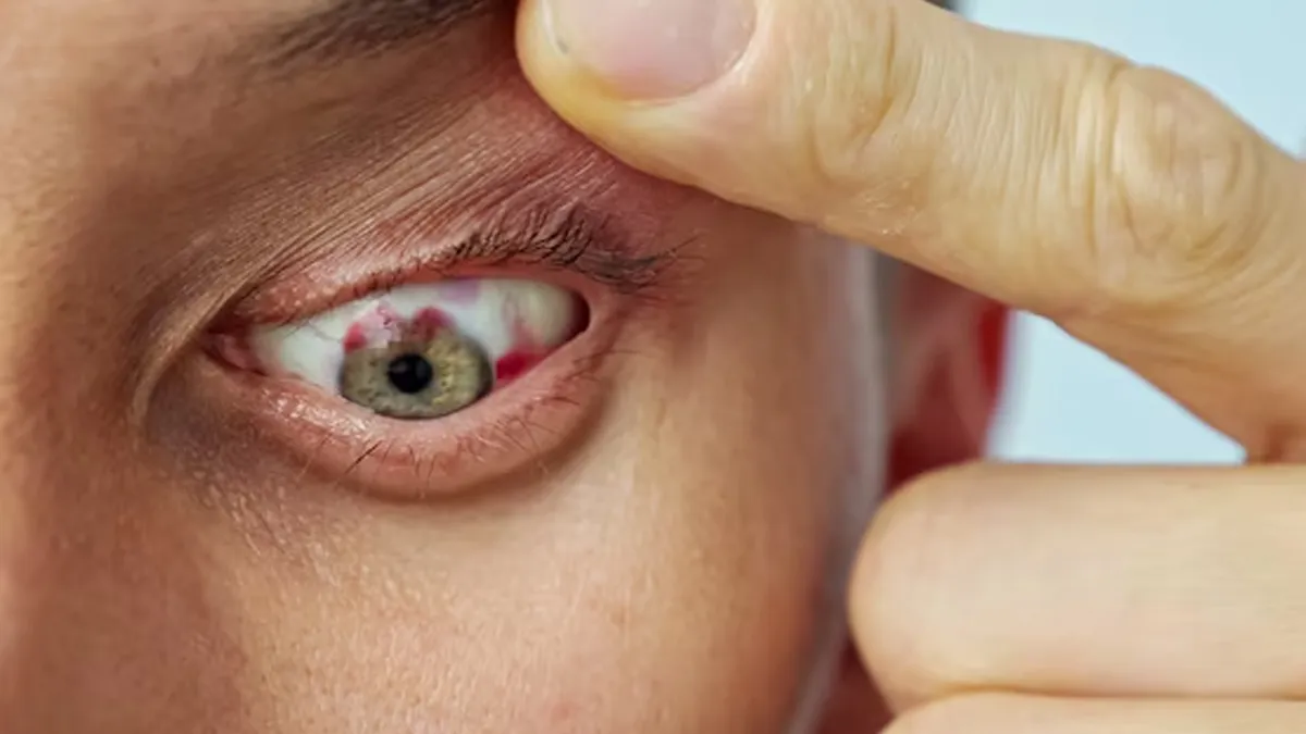 can eye cancer be cured