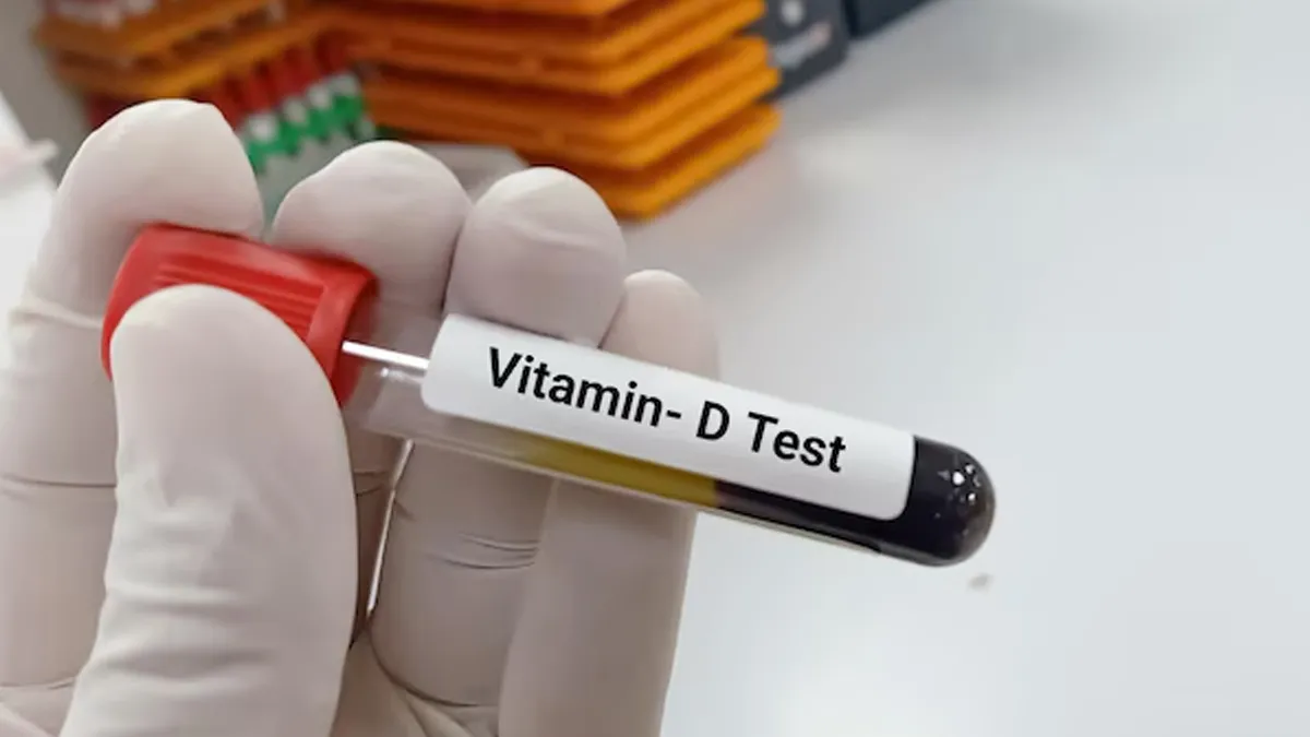 vitamin d level