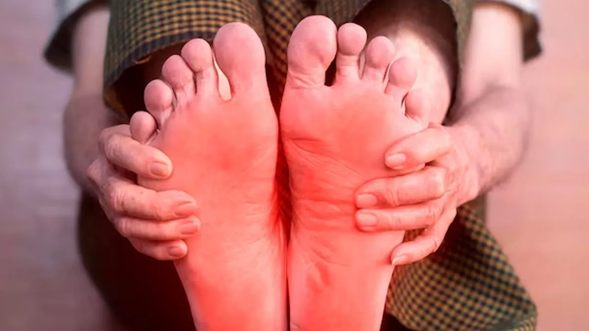 Burning sensation in hands and feet
