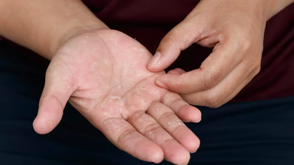 What to Apply on dry hand