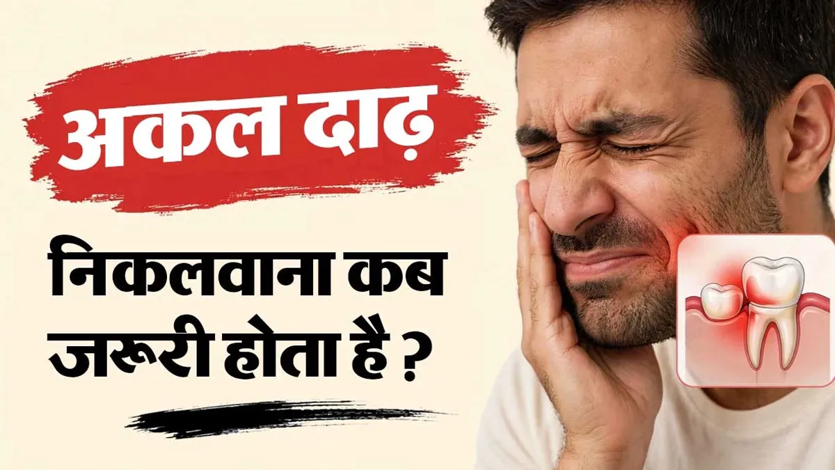 अकल दाढ़ निकलवाना कब जरूरी होता है? डॉक्टर से जानें