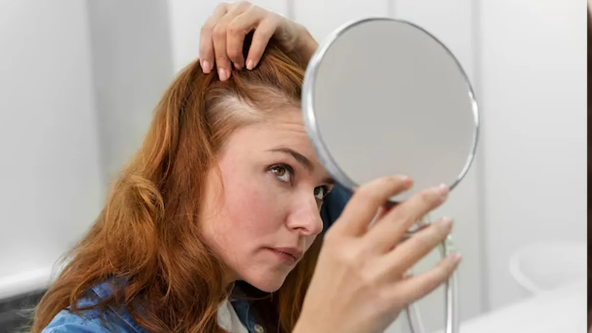 hair fall after fever