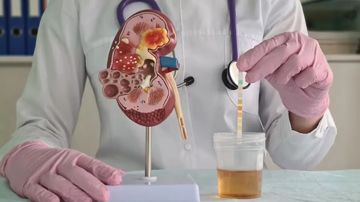 urine frequency in diabetes