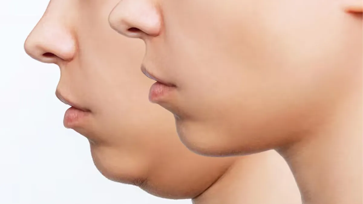 1 (47)