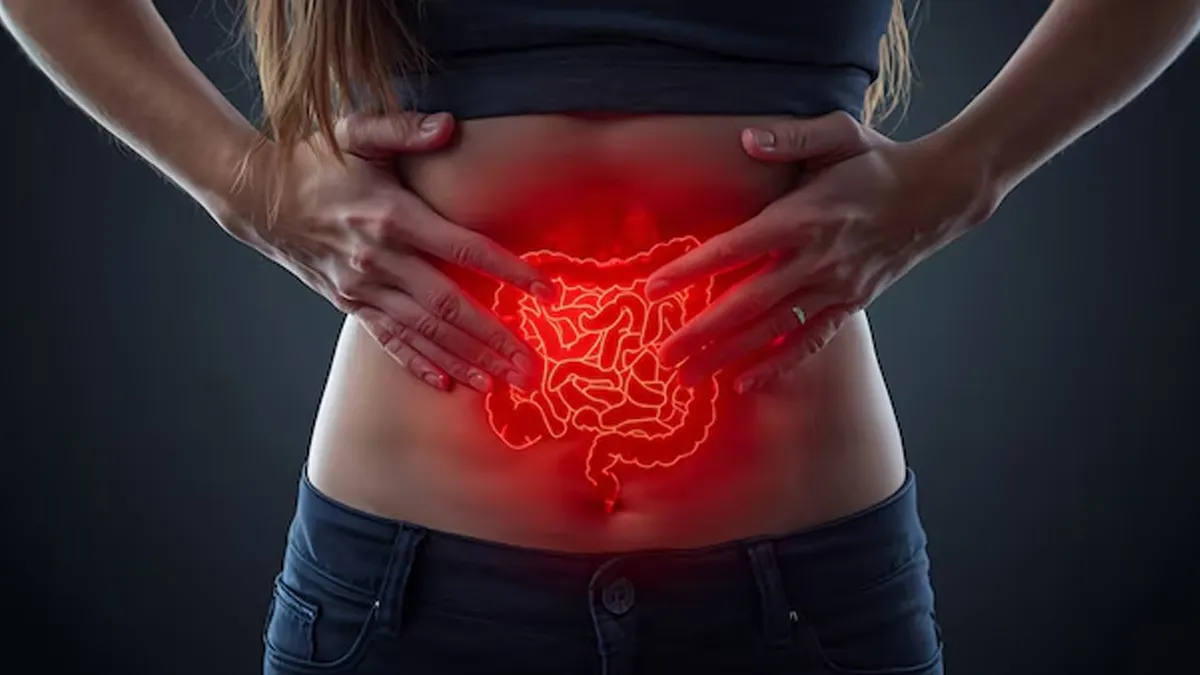  food for Intestinal Inflammation