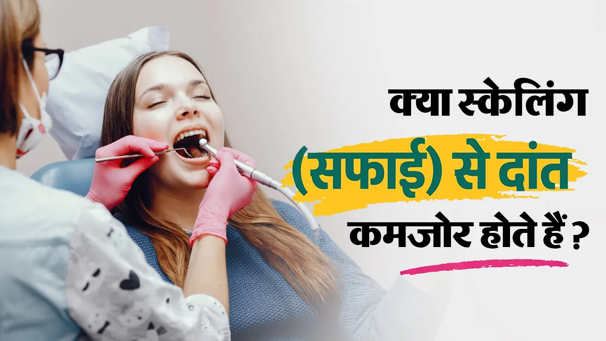 क्या दांतों की सफाई (स्केलिंग) कराने से दांत कमजोर हो जाते हैं? डॉक्टर से जानें