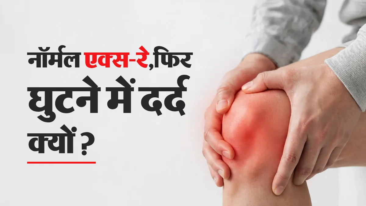 घुटनों में दर्द है, लेकिन एक्स-रे नॉर्मल है? डॉक्टर से जानें इसके पीछे की वजह