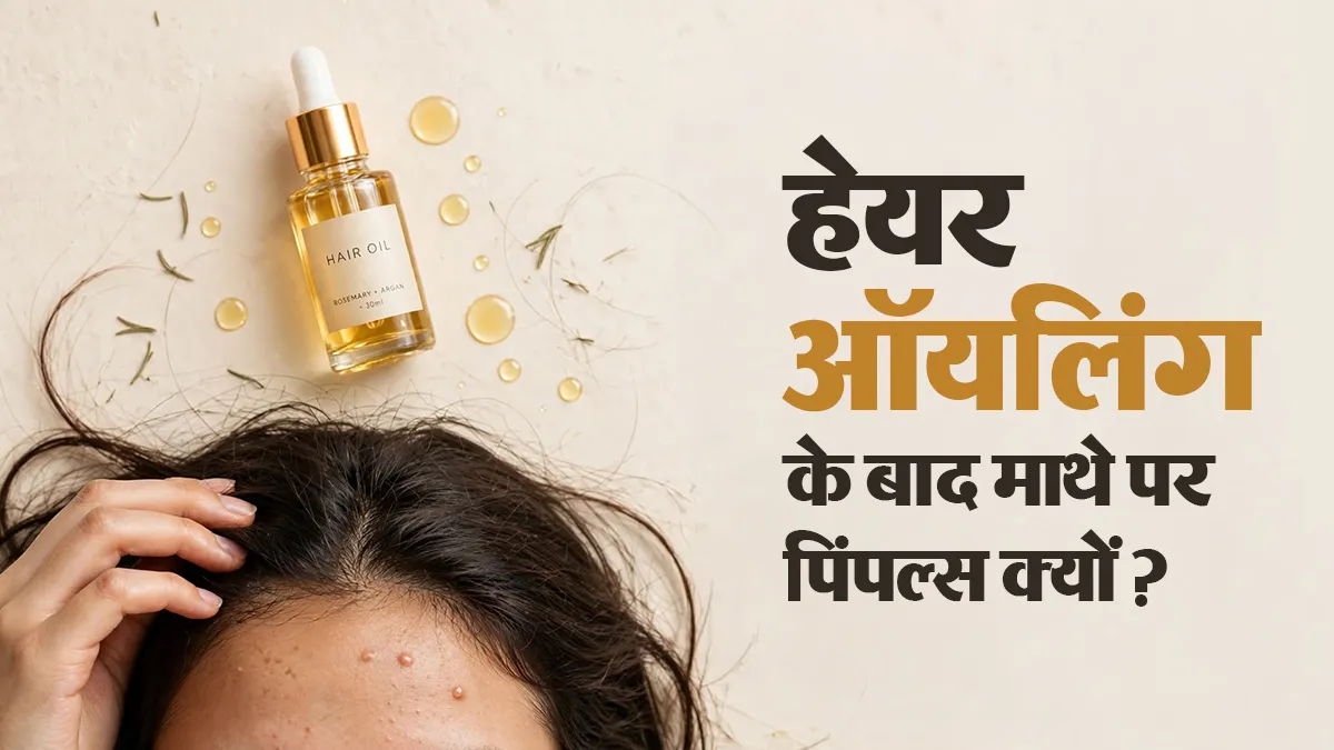हेयर ऑयल लगाने के बाद माथे पर निकल आते हैं मुंहासे? डर्मेटोलॉजिस्ट से जानें वजह