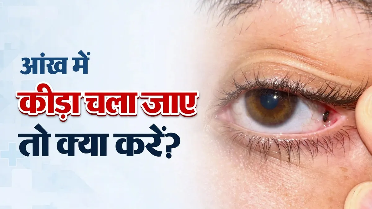 आंख में कीड़ा चला जाए तो क्या करें? डॉक्टर से जानें कब घर पर इलाज कर सकते हैं, कब नहीं