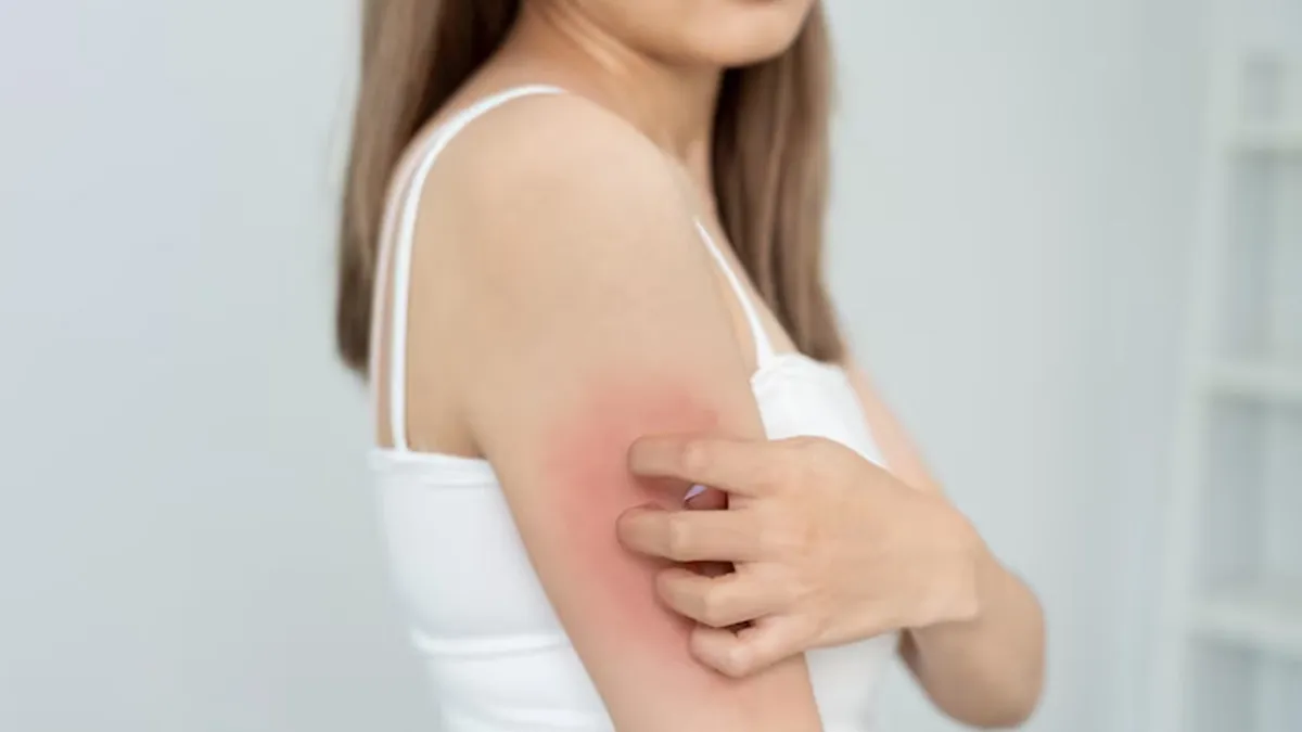 remedies-for-skin-itching