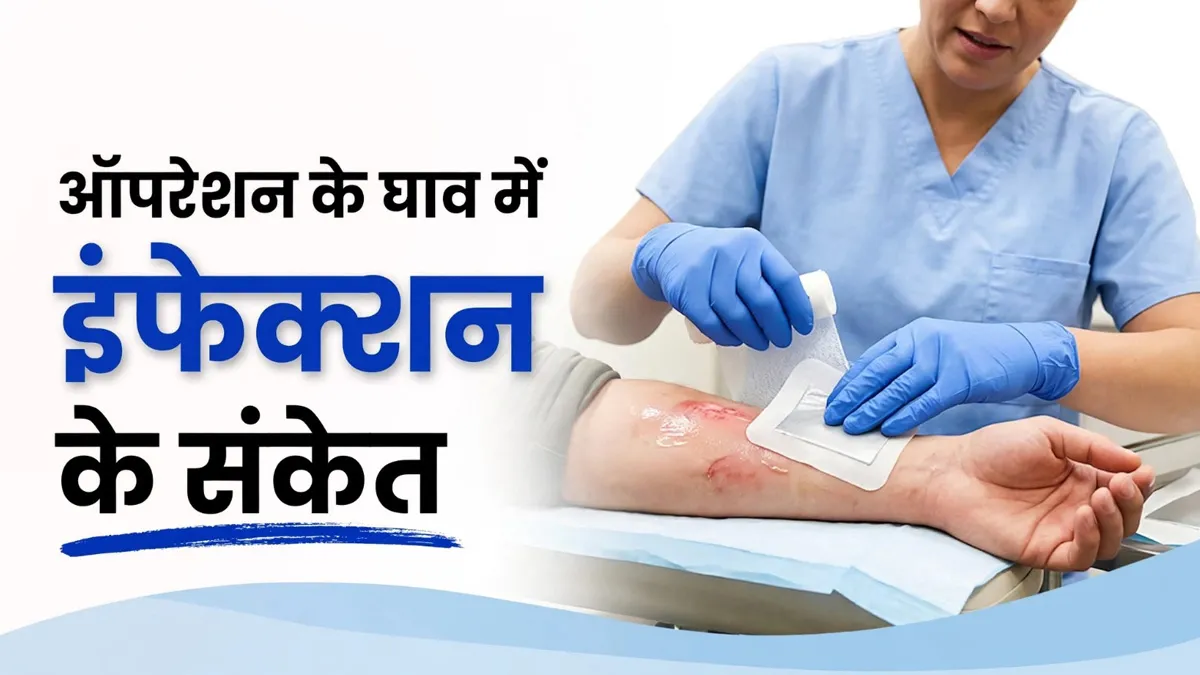 ऑपरेशन के घाव में इंफेक्शन हो गया है? लालिमा से पस निकलने तक, इन 5 संकेतों को न करें नजरअंदाज
