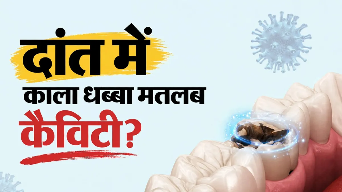क्या दांत का हर काला धब्बा कैविटी होता है? डेंटिस्ट से जानें