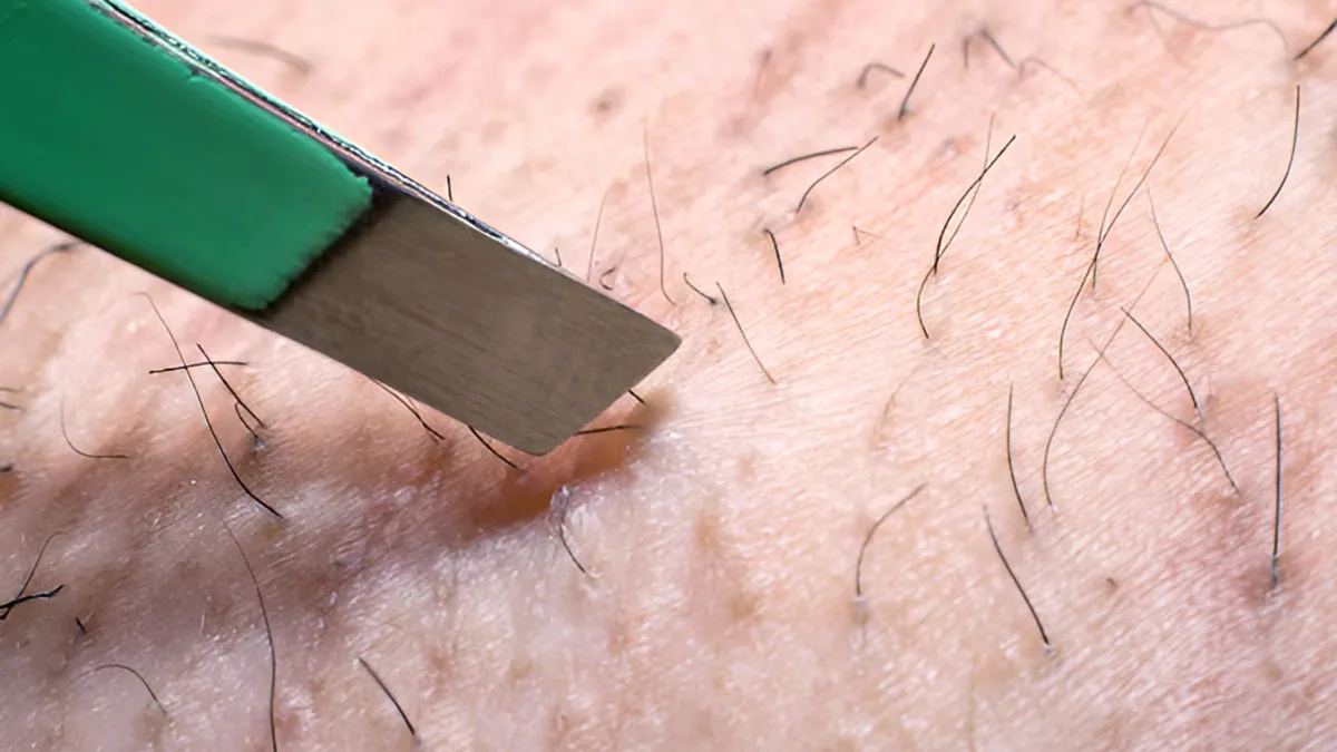 ingrown-hair-prevention