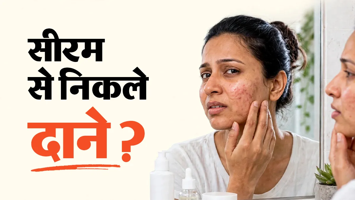 नया फेस सीरम लगाने के बाद निकल आए दाने? डर्मेटोलॉजिस्ट से जानें प्रोडक्ट सूट न करने के संकेत