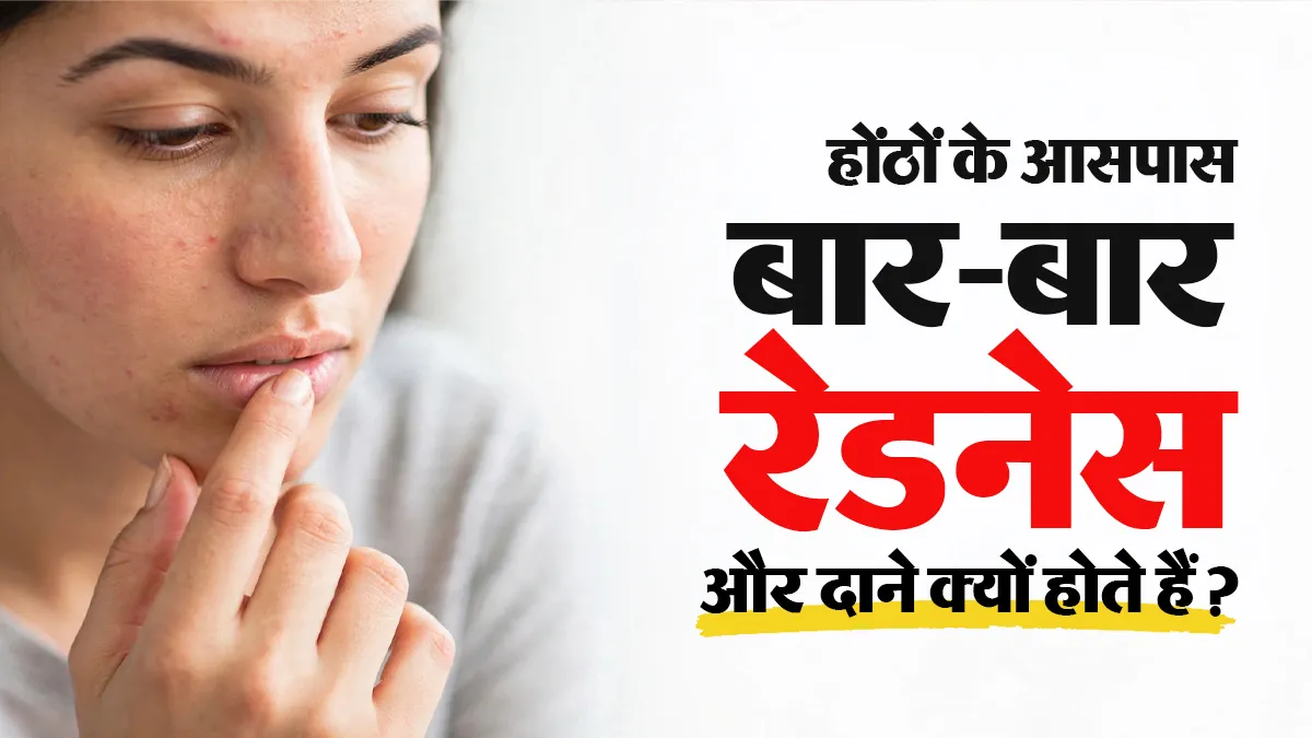 होंठों के आसपास बार-बार रेडनेस और दाने क्यों होते हैं? क्या स्किन क्रीम इसकी वजह हो सकती है?