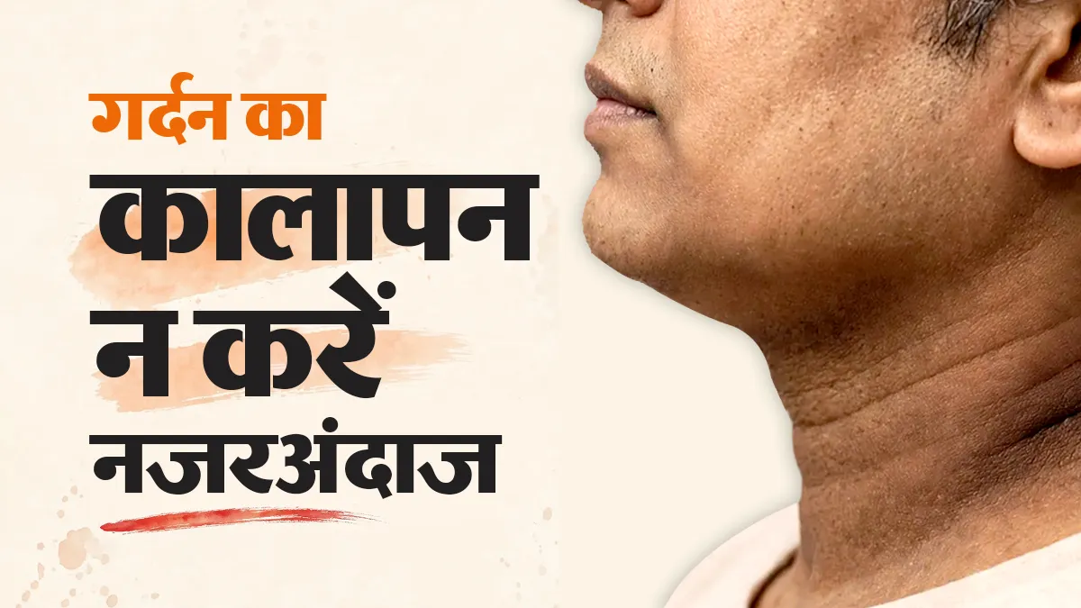 गर्दन की त्वचा काली और मोटी हो रही है? इसे सिर्फ गंदगी समझकर न छोड़ें, डॉक्टर से जानें इसके पीछे की वजह