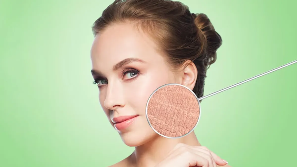 Which Skin Condition Causes Flaky Skin