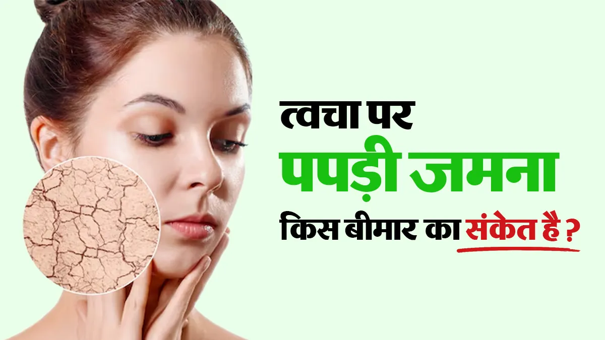 चेहरे और कानों के पीछे पपड़ी जमना: डॉक्टर बता रहे हैं ये किन बीमारियों का संकेत है?