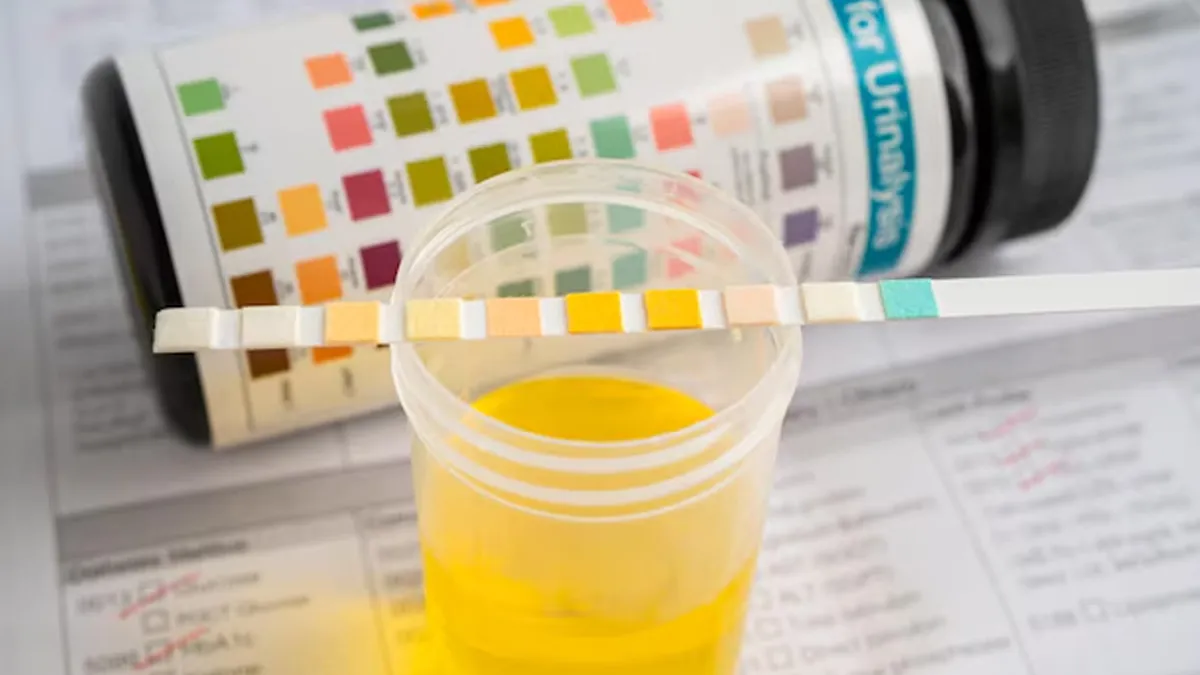 how to read urine report