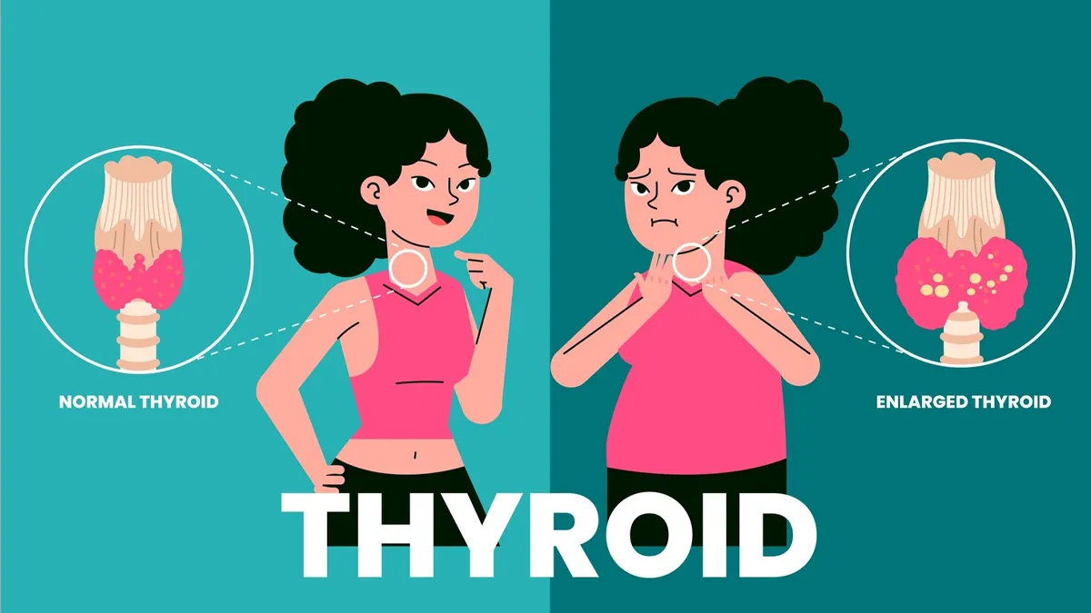 protein deficiency vs thyroid hair fall