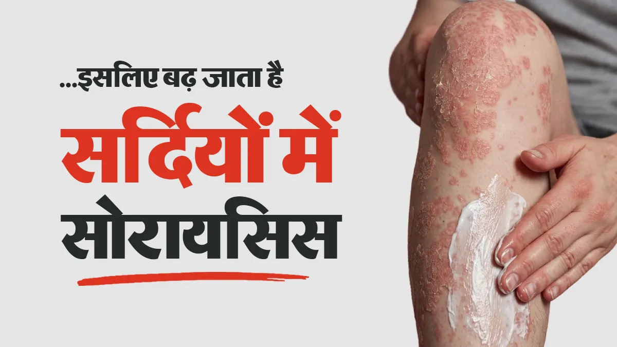 World Psoriasis Day: सर्दियों में सोरायसिस क्यों बढ़ जाता है? डॉक्टर ने बताए इसके 5 बड़े कारण
