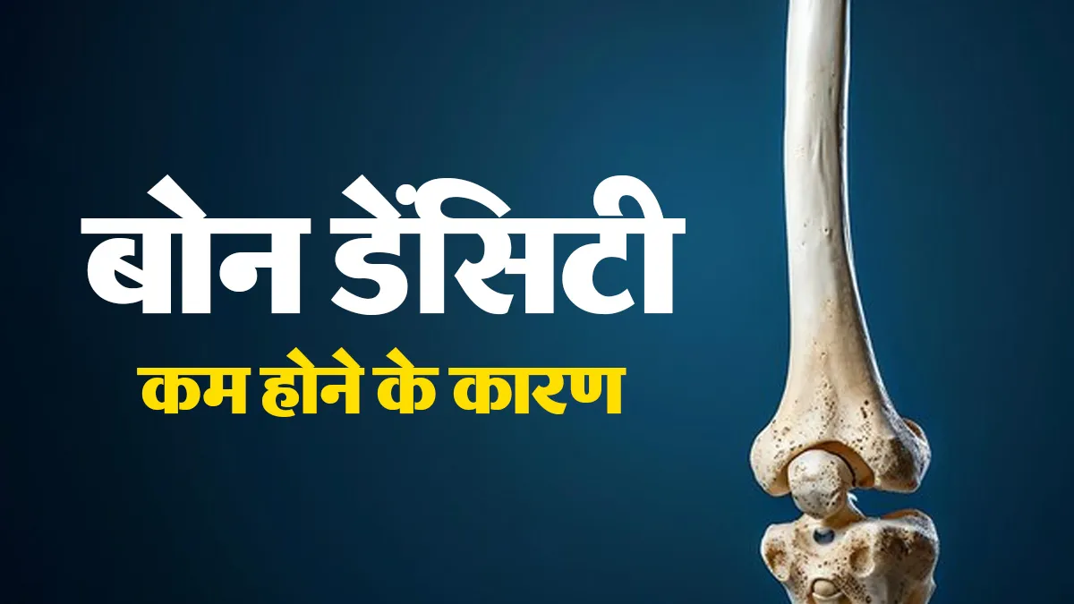 बोन डेंसिटी कम होने के क्या कारण हैं? डॉक्टर से जानें
