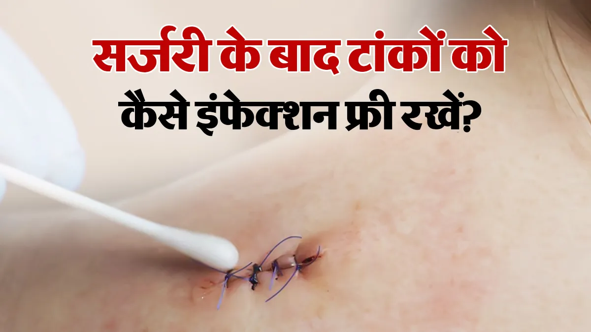 सर्जरी के बाद टांकों की देखभाल कैसे करें? डॉक्टर से जानें इंफेक्शन के शुरुआती संकेत