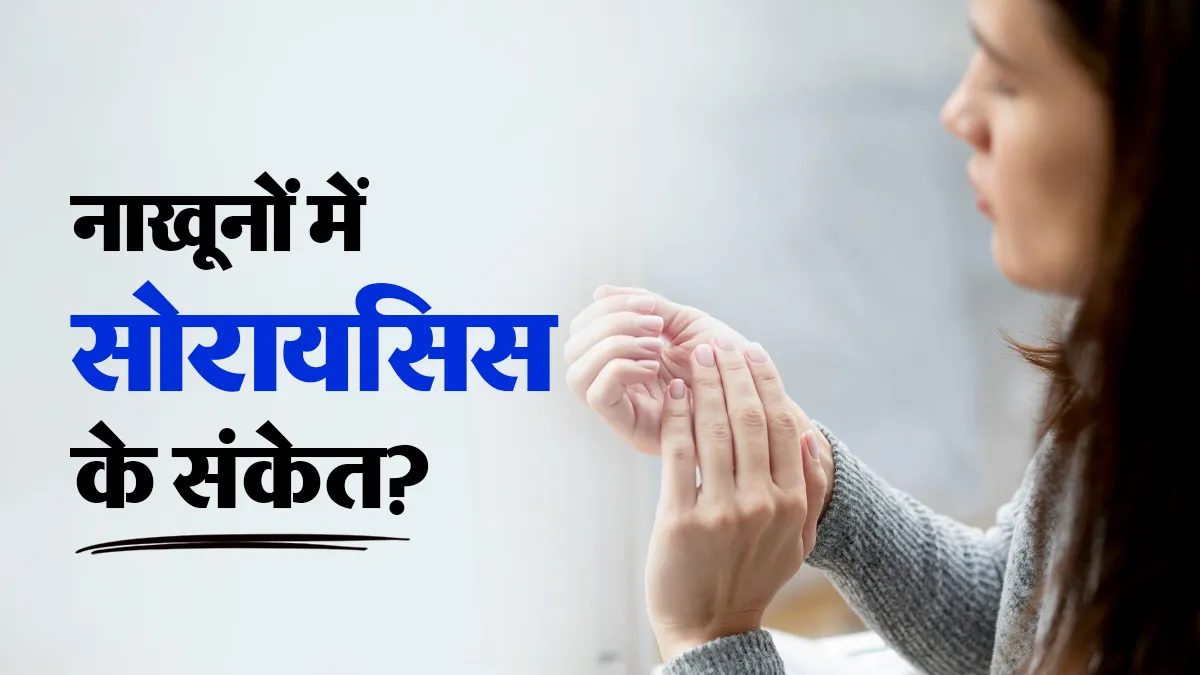 World Psoriasis Day: नाखूनों में गड्ढे, मोटापन या रंग बदलना क्या सोरायसिस का संकेत है? जानें कब जांच कराएं