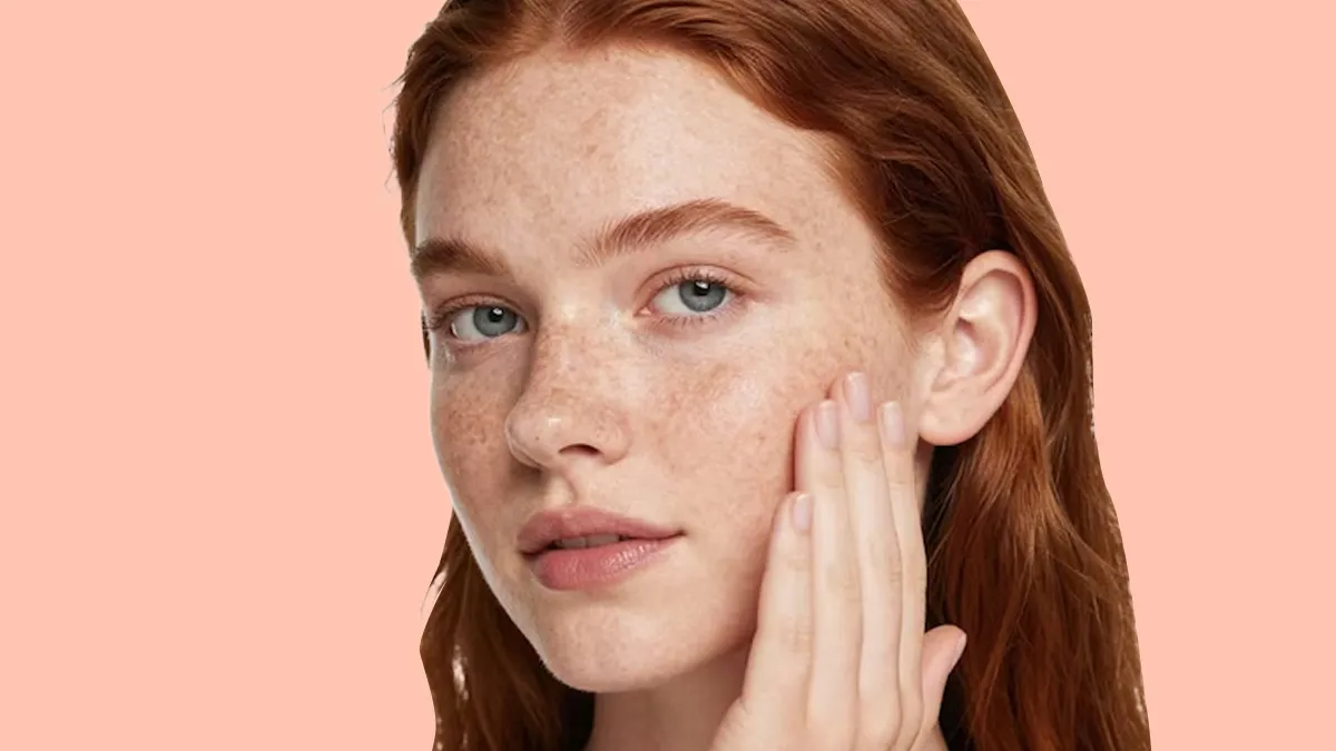 Cause Of Melasma Brown Patches On Face