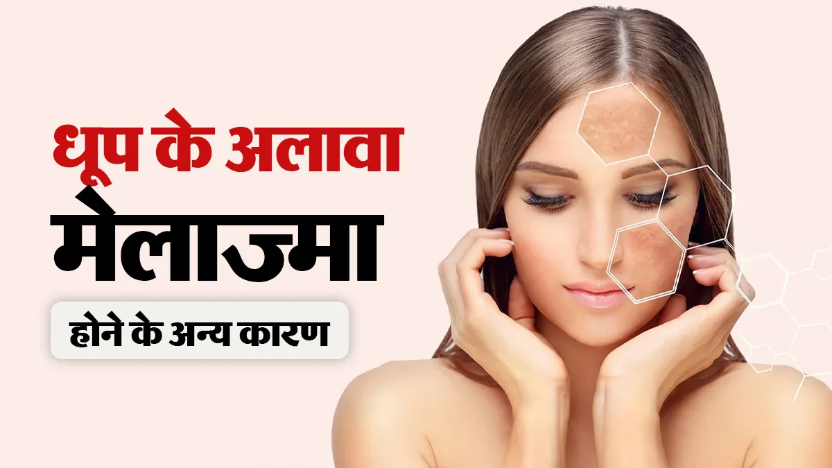सिर्फ धूप के कारण नहीं होती है चेहरे पर भूरे पैच (मेलाज्मा) की समस्या, जानें क्या हैं इसकी अन्य वजहें