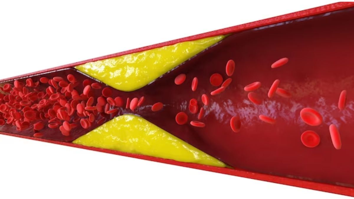 cholesterol control tips