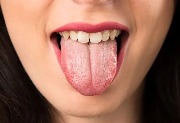 நாக்கில் இப்படி இருந்தால் புற்றுநோய் அறிகுறியாக இருக்கலாம்!