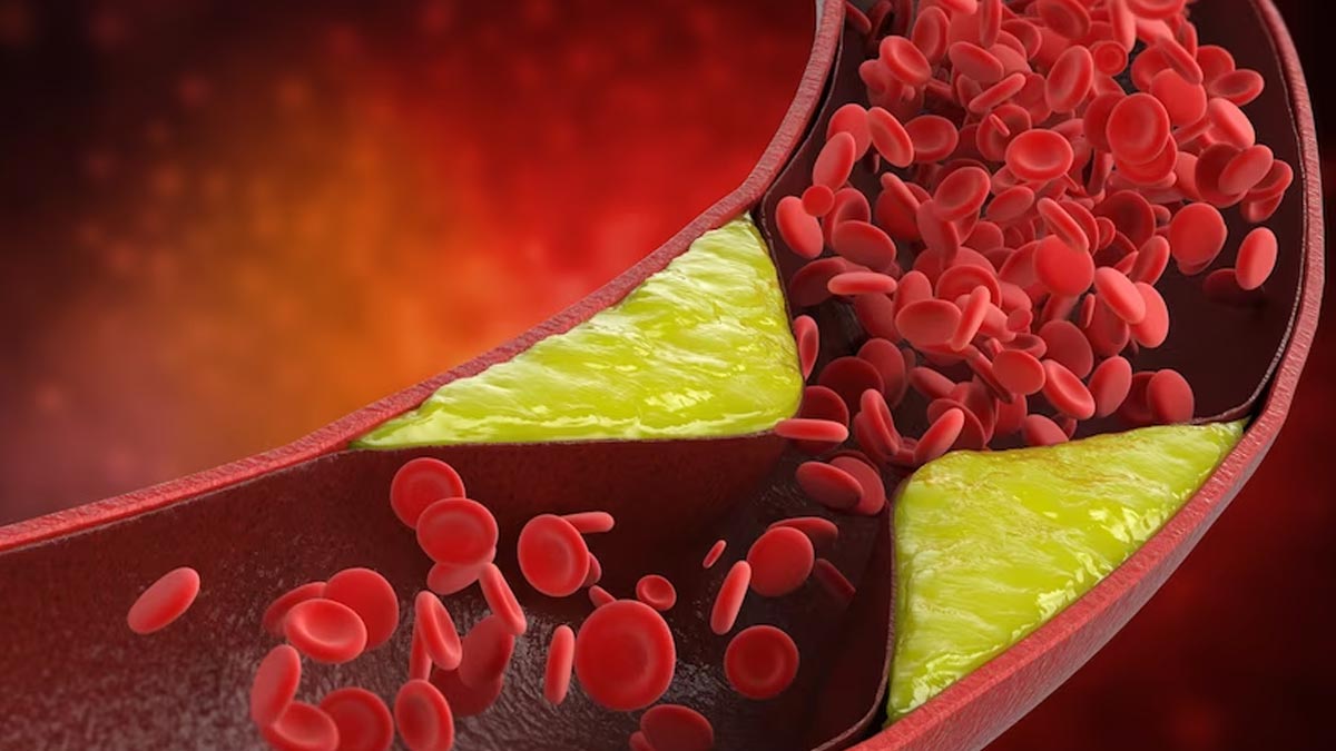 cholesterol-level