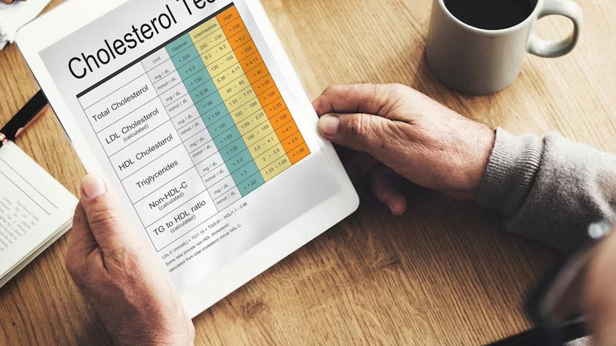cholesterol-level-test