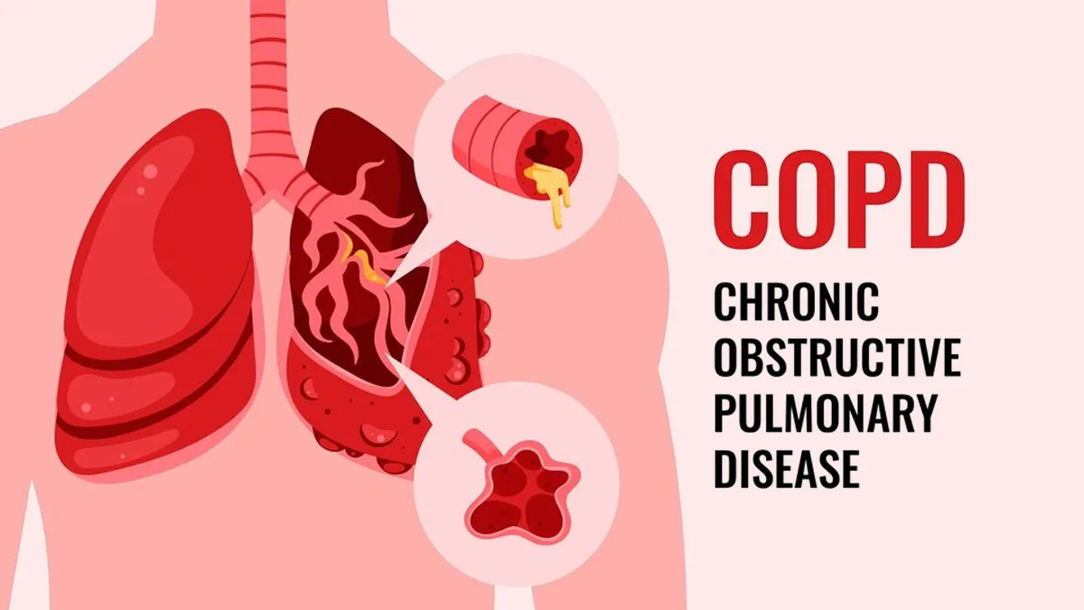 COPD Diet: உங்களுக்கு COPD இருக்கா.? இத மட்டும் சாப்பிடுங்க..
