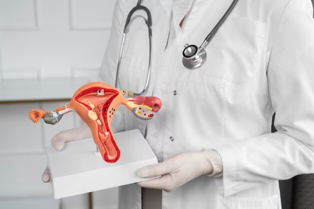 ovarian cancer